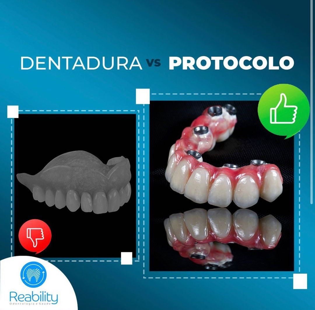 DESAFIO DAS ARCADAS:DENTADURA X PROTOCOLO!